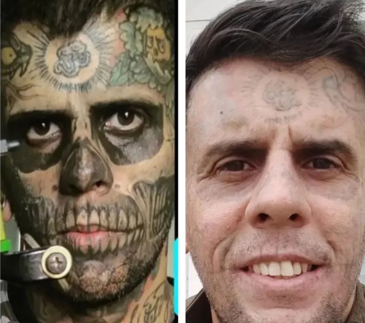 Homem Mais Tatuado do Brasil Enfrenta Nova Batalha Contra Tumor